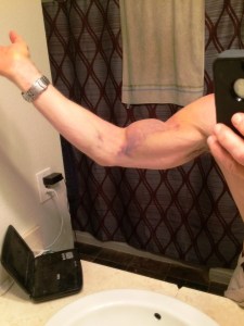 Bicep 2